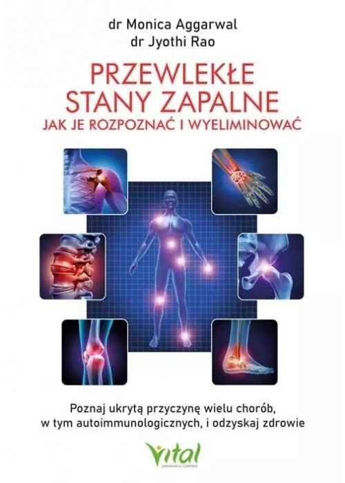 Przewlekłe stany zapalne jak je rozpoznać