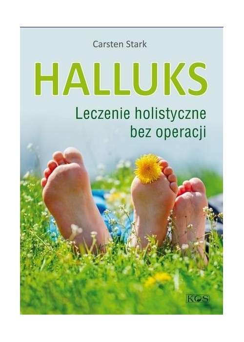 Halluks. Leczenie holistyczne bez operacji