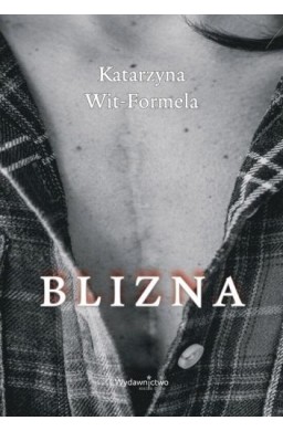 Blizna