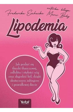 Lipodemia