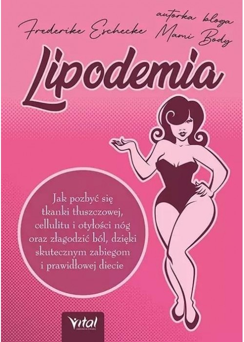 Lipodemia